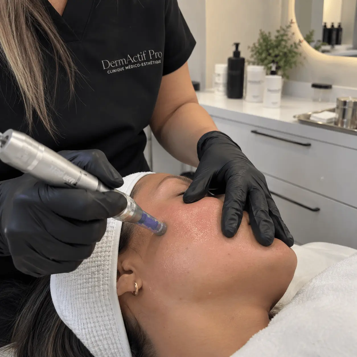 Microneedling